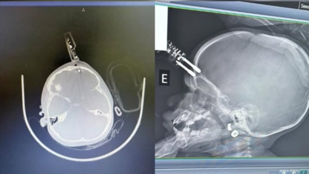 2ebc7ff2-bebe-carregador-compressed