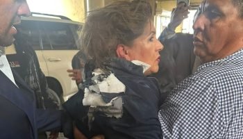 4b40c99f-deputada-e-atingida-na-cabeca-por-explosivo-durante-entrevista-em-honduras