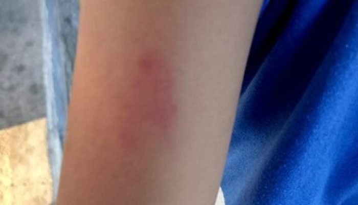 566421435_826970090287551_8816388851873915816_n-640x330