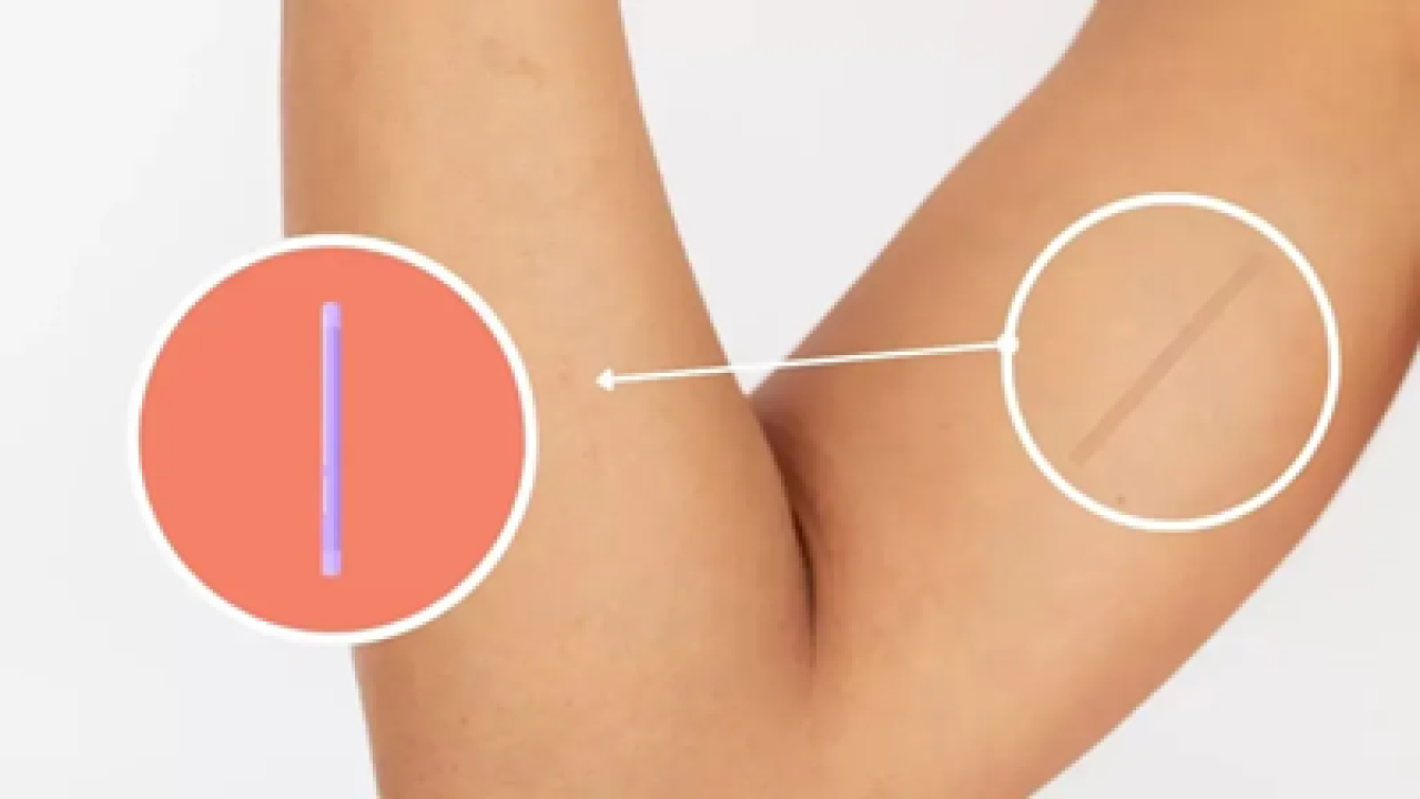 5dd24123-7f1d-4848-a7fe-33fed15098b9