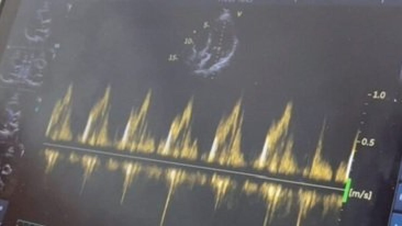 IMG_6801-640×330-1 IMG_6801-640x330-1