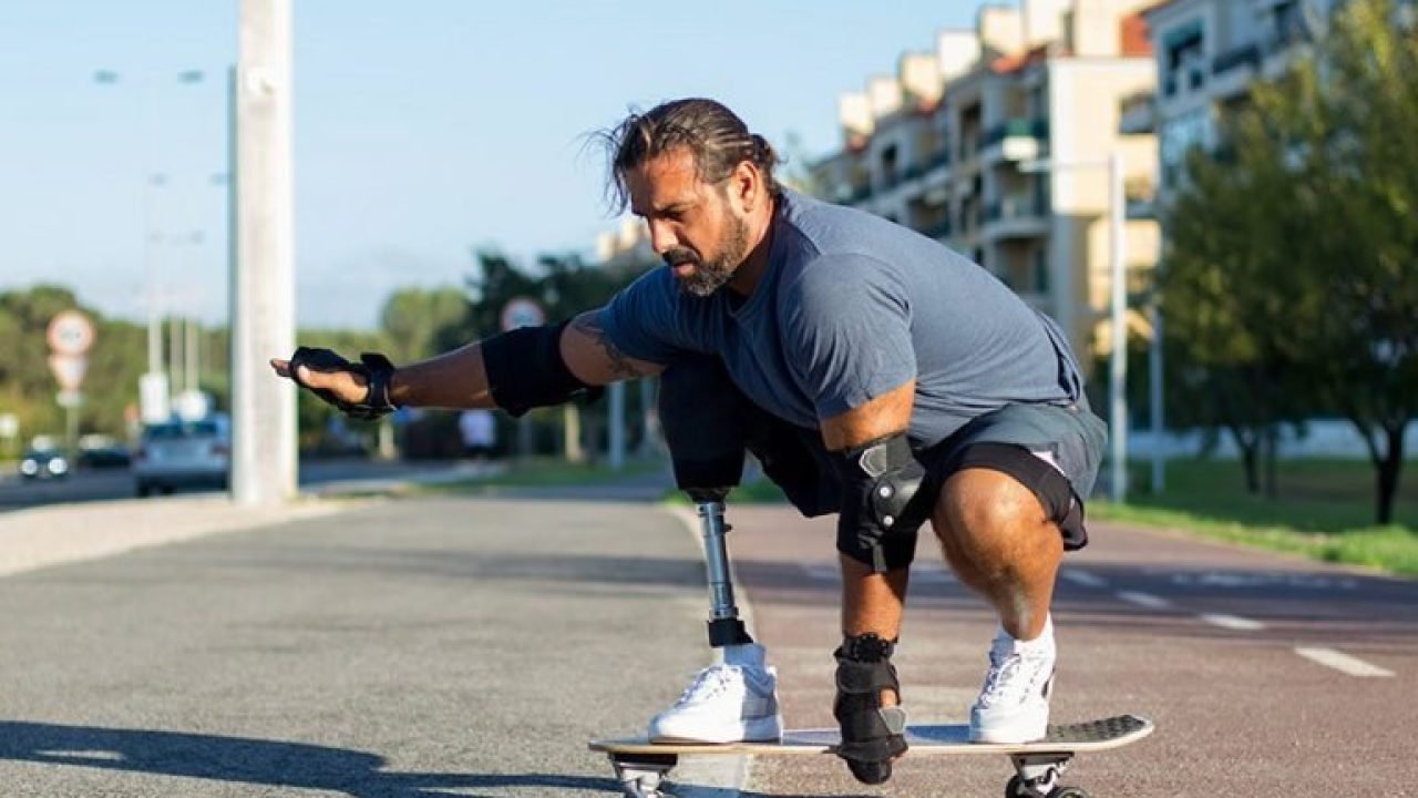 agenesia-de-membros-768x509