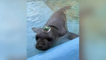 blefaroplastia-entenda-detalhes-da-cirurgia-feita-por-leonardo-5