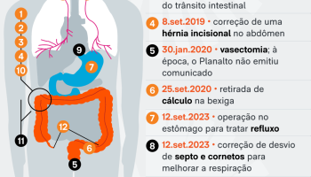 cirurgias-bolsonaro-saude-12-abr-2025-01-scaled-1