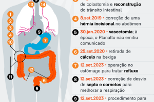 cirurgias-bolsonaro-saude-12-abr-2025-01-scaled-2