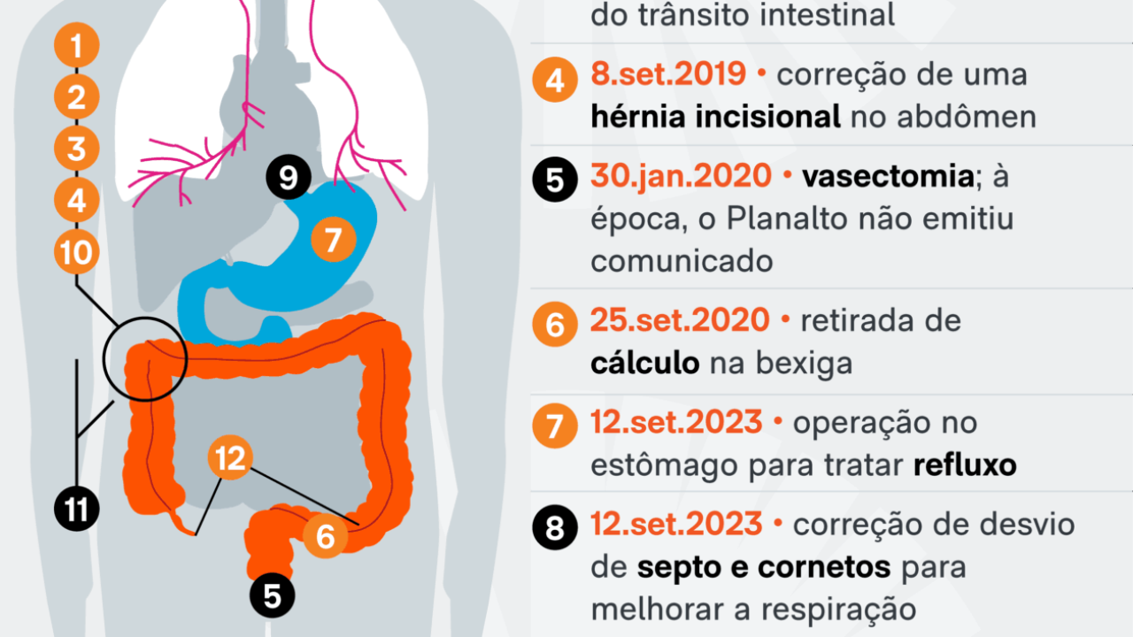 cirurgias-bolsonaro-saude-12-abr-2025-01-scaled-2