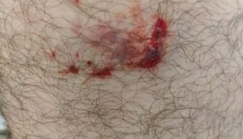 fa031b92-0854-447f-9d87-28122c95ae41-482x330