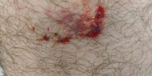 fa031b92-0854-447f-9d87-28122c95ae41-482x330