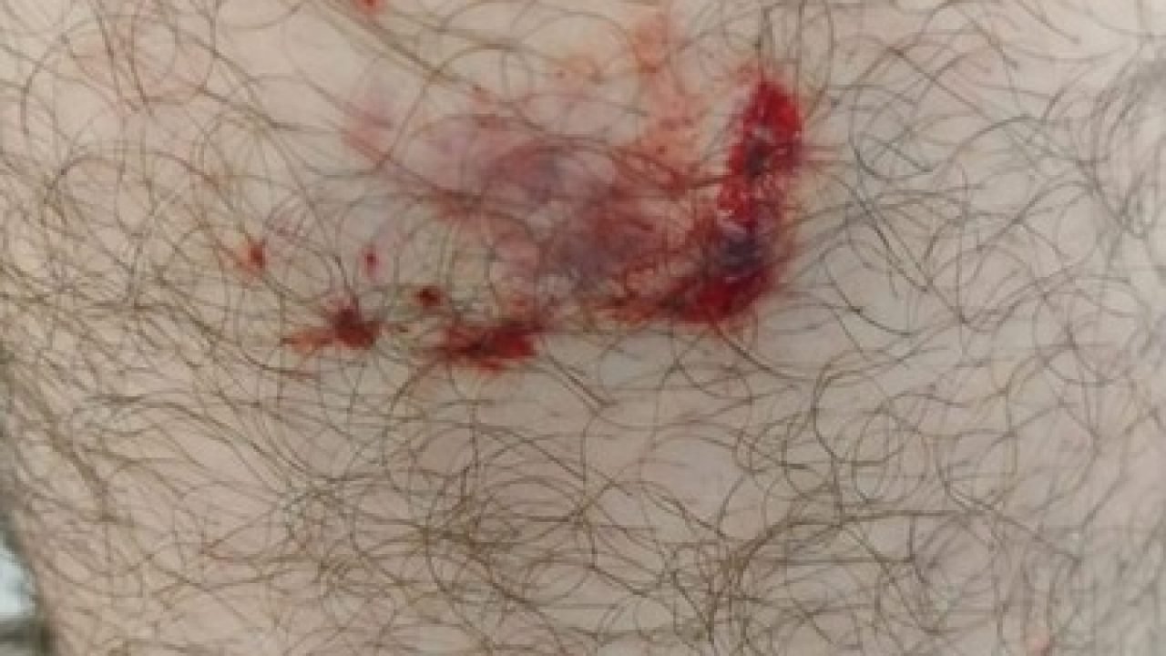 fa031b92-0854-447f-9d87-28122c95ae41-482×330 fa031b92-0854-447f-9d87-28122c95ae41-482x330