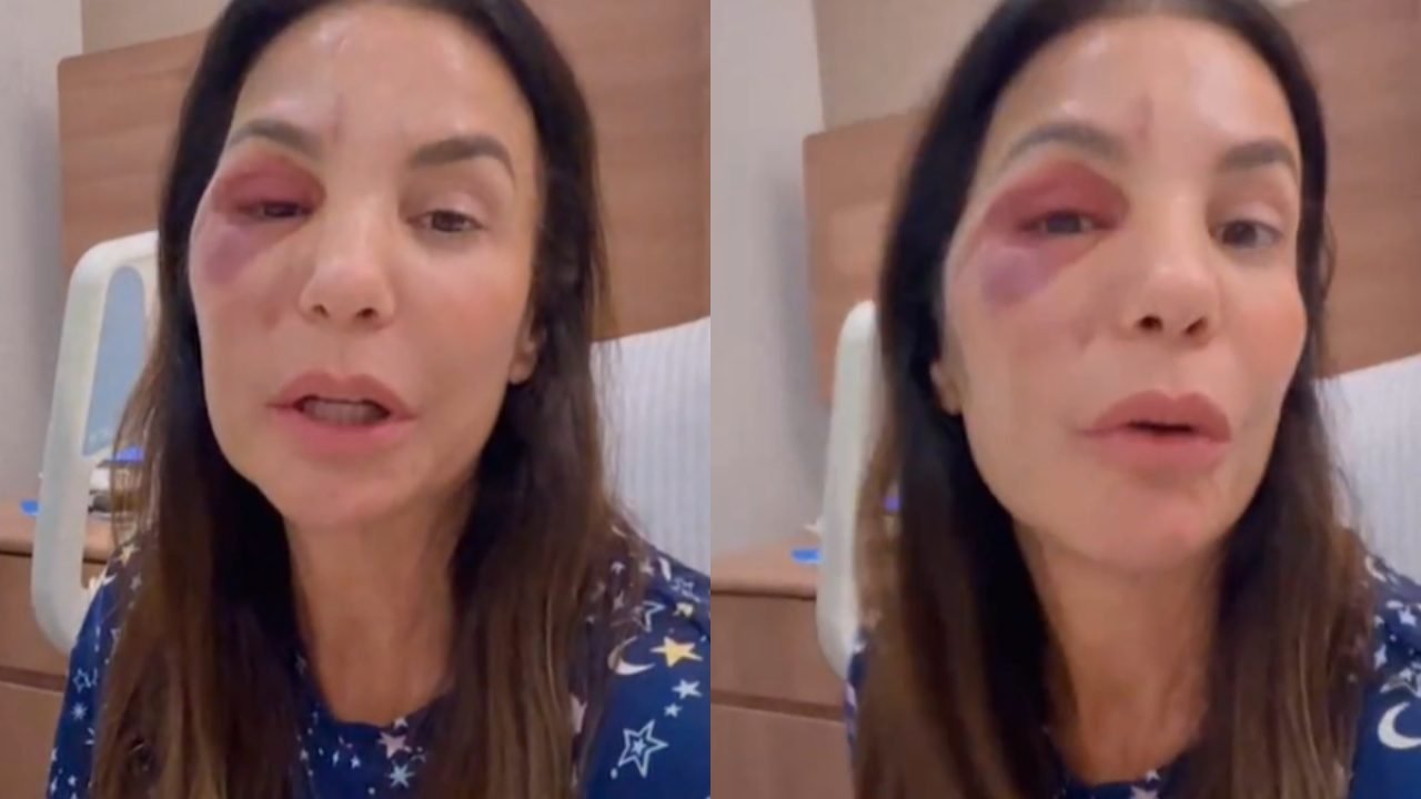 ivete-sangalo-fala-pela-1-vez-rumores-de-agressao A cantora Ivete Sangalo — Foto: 1 de 1 ivete-sangalo-fala-pela-1-vez-rumores-de-