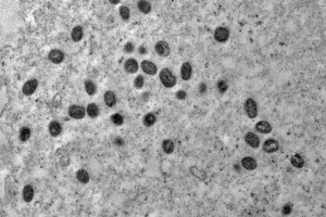 Vírus da Mpox é do mesmo grupo da varíola e sua transmissão acontece principalme