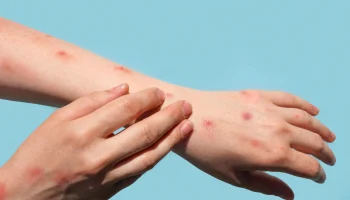 Foto: Notícias ao Minuto