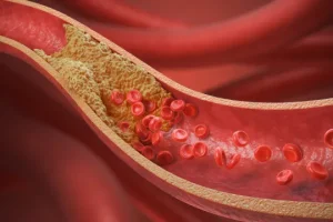 10 alimentos que cardiologistas indicam para baixar o colesterol — Foto: 10 alim