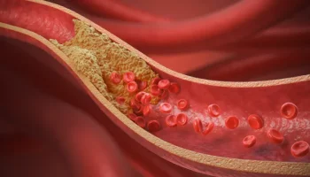 10 alimentos que cardiologistas indicam para baixar o colesterol — Foto: 10 alim