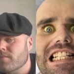 Imagem colorida mostra homem branco com os olhos amarelados — Foto: 1 de 1 Image